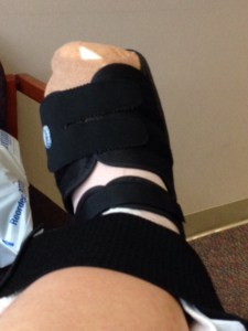 The foot right after surgery